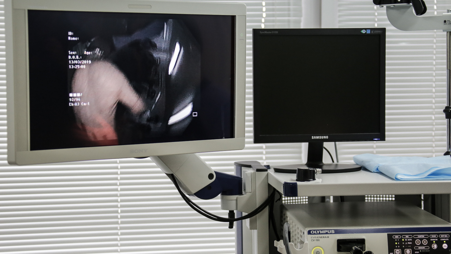 В ХМАО из-за санкций закрывают рентгенкабинеты в больницах